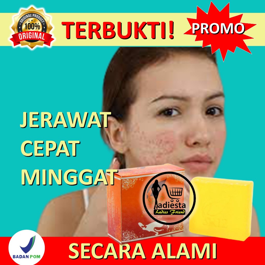 Sabun Cuci Muka Wajah Pria Obat Jerawat Perawatan Skincare Wajah Berjerawat