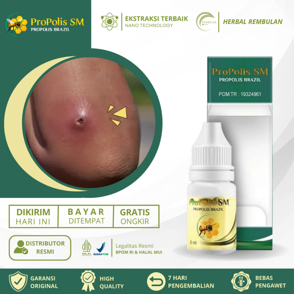 Obat Bisul, Bisul Di Pantat, Obat Bisul di Kelamin, Obat Bisul Bayi Anak Dan Dewasa, Bisul Bernanah,