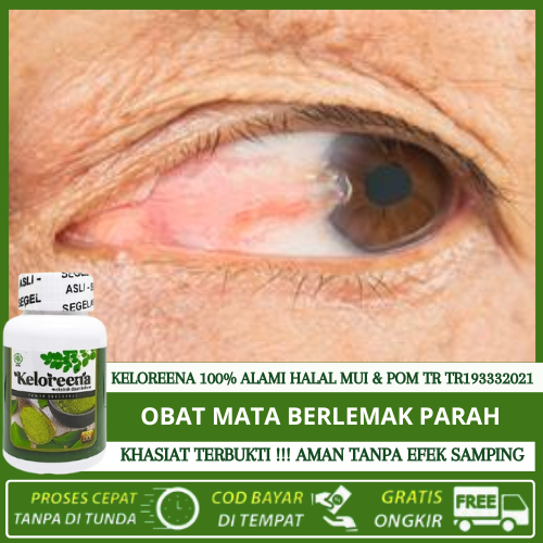 Obat Mata Berlemak Parah, Obat Lemak Mata, Penghilang Gumpalan Lemak Di Mata, Menghilangkan Lemak Di