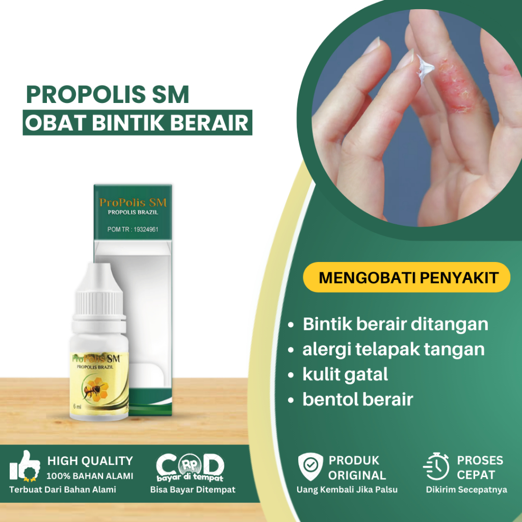 Obat Bintik Berair Di Telapak Tangan, Obat Alergi Telapak Tangan, Obat Penghilang Gatal Dan Bintik B