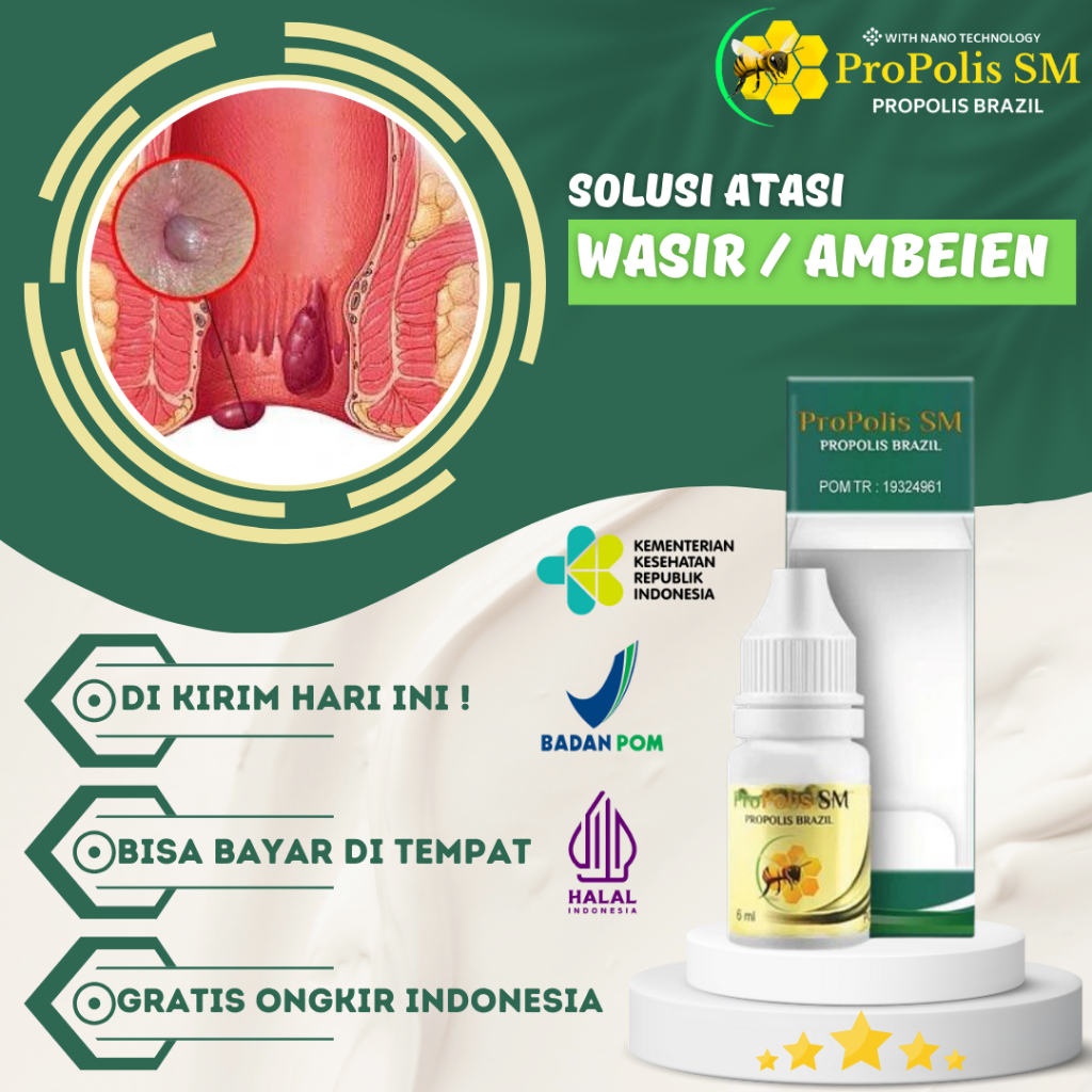 Obat Fistula Ani - Obat Wasir Ambeien Benjolan Gatal Susah BAB Keras Abses Anus Obat Oles Benjolan W