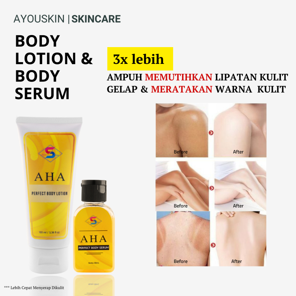 Body Lotion AHA - Meratakan Warna Kulit, Penghilang Kulit Belang Kaki dan Tangan, Pemutih Kulit Bela