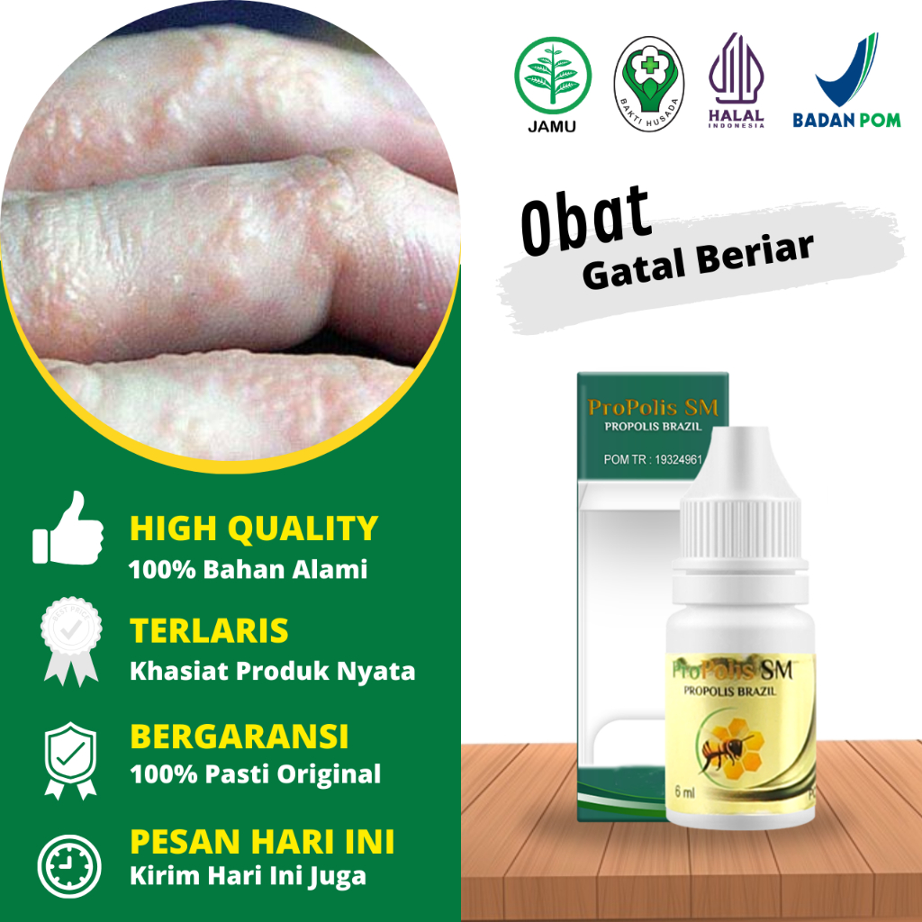 Obat Gatal Berair Dan Bernanah, Obat Gatal Berair Di Tangan - Obat Gatal Berair Di Jari Tangan - Oba