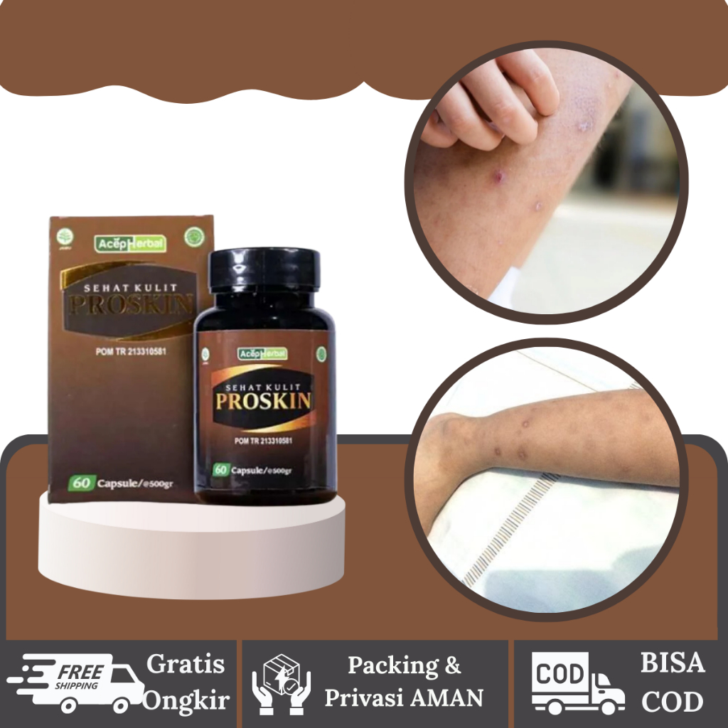 Herbalthy - Obat penghilang bekas luka - Obat Koreng di Kaki - Proskin 60 Kapsul