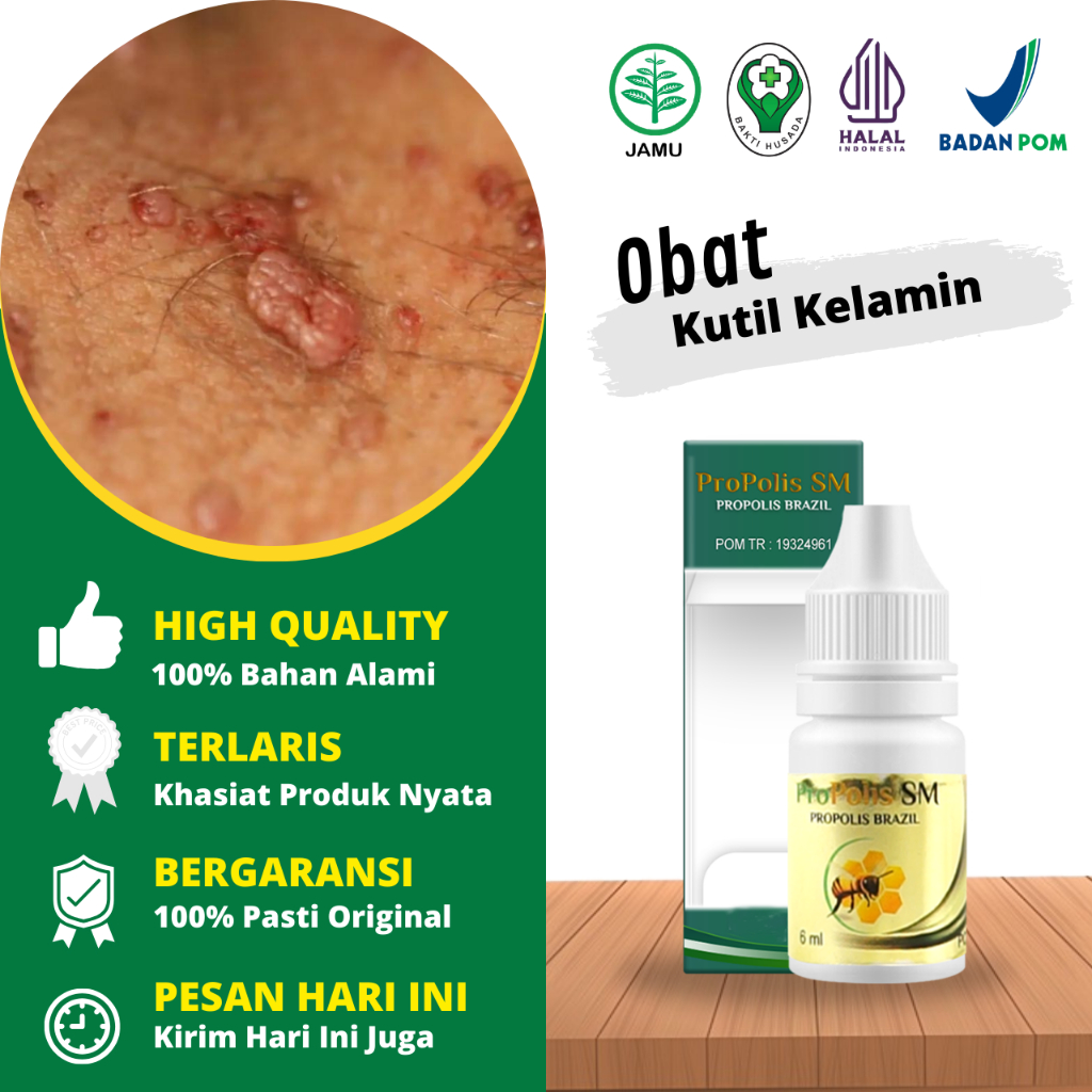 Obat Kutil Kelamin, Obat Kutil Kelamin Wanita, Obat Kutil Kelamin Pria, Obat Kutil Kelamin Hpv, Obat