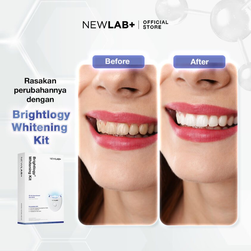 NewLab Pro Teeth Whitening Kit | Alat Pemutih Gigi Permanen| Bleaching Gigi Image 5