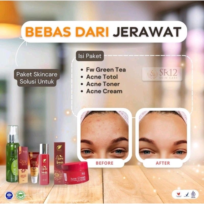 PAKET SKINCARE JERAWAT SR12 / SOLUSI BEBAS DARI JERAWAT / HEMPASKAN JERAWAT