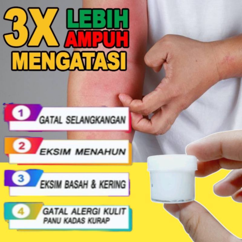 salep gatal racikan spesialis kulit paling ampuh