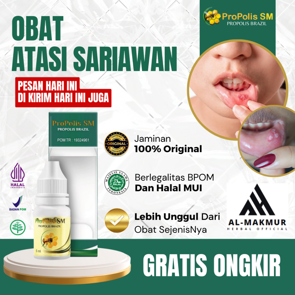 Obat Tetes Sariawan Pinggir Bibir, Obat Totoaeun, Obat Sisi Bibir Hitam, Obat Agular Cheilitis Untuk