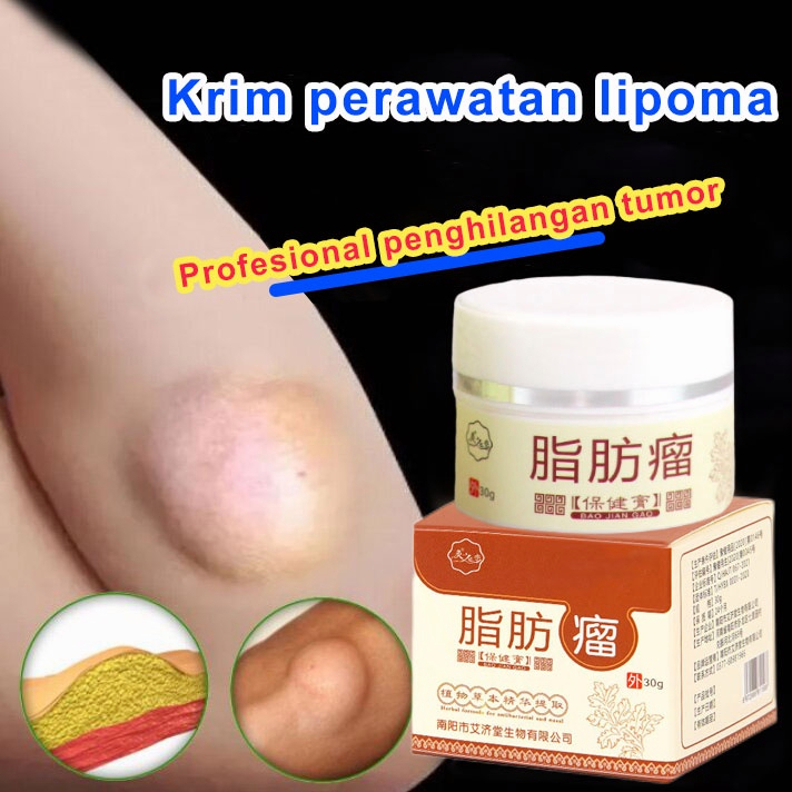 【COD ORI】Lipoma Cream Original Salep Lipoma Salep Benjolan Obat Benjolan Lipoma Di Leher Tangan Dan 