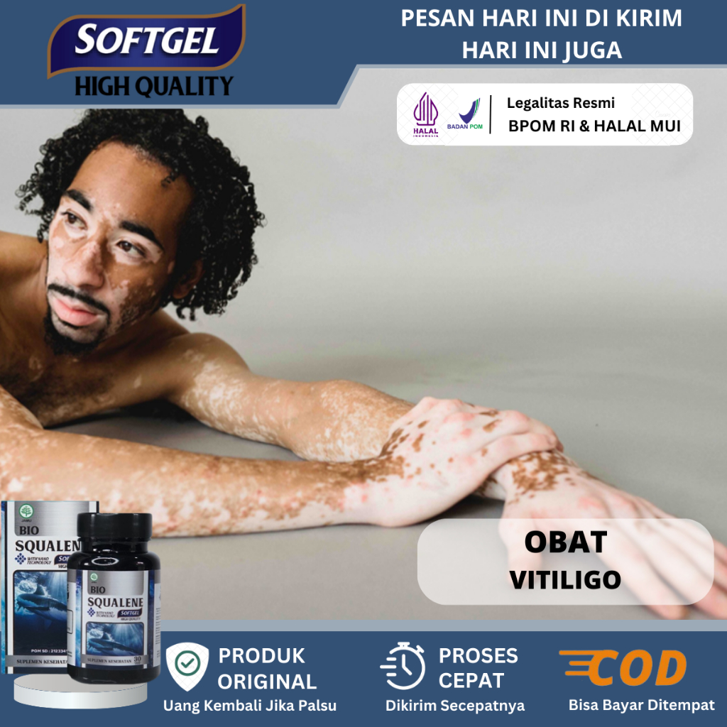 Obat Vitiligo Kulit Bercak Putih, Obat Penghilang Bercak Putih Vitiligo, Obat Kekurangan Pigmen Kuli