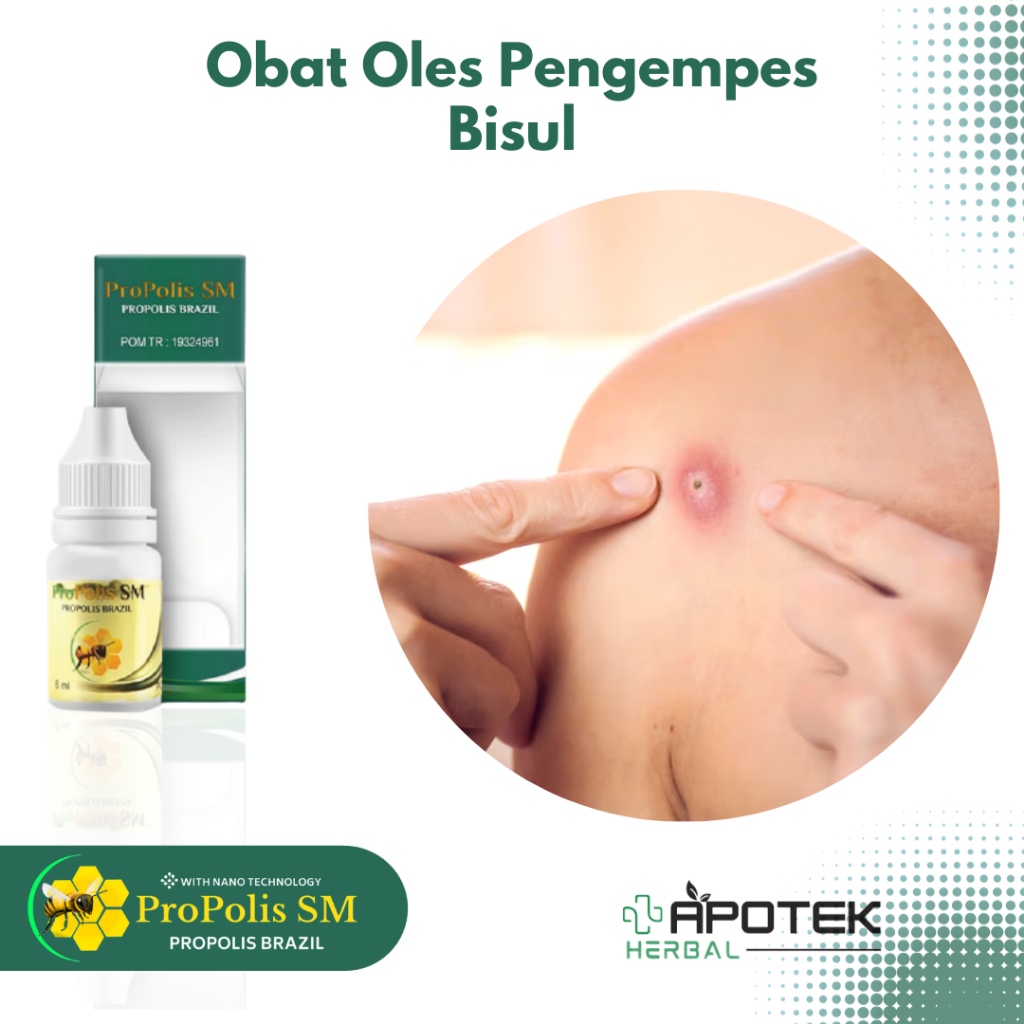 Obat Bisul Benjolan Merah Bernanah Obat Bisul di Pantat Kelamin Wajah Ketiak Abses Kulit Furunkel Ob