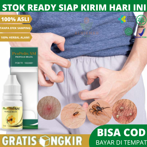 Obat Gatal Kelamin Pria, Salep Gatal Buah Zakar Pria, Obat Gatal Kutu Kelamin, Gatal Bentol Di Bulu 