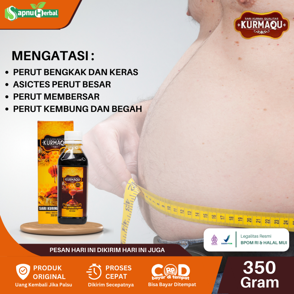 Obat Perut Bengkak Dan Keras Asites Perut Bengkak Ascites Perut Membesar Perut Besar Perut Kembung D