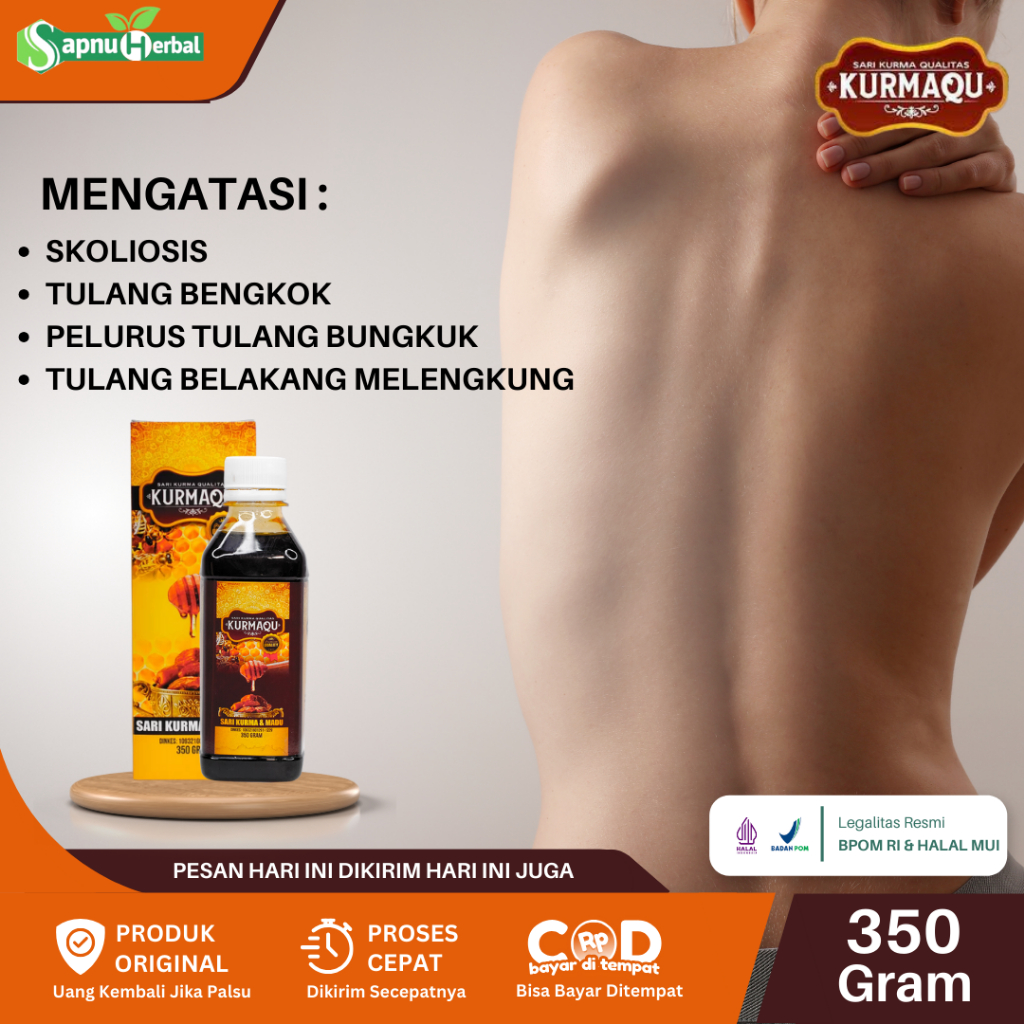 Obat Skoliosis Tulang Bengkok Pelurus Tulang Bengkok Tulang Belakang Bengkok Gangguan Tulang Belakan