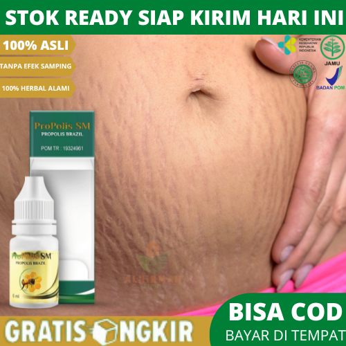 Obat Memudarkan stretch mark / Singkayo Garis Halus Di Perut Setelah Melahirkan, Obat Memudarkan Sin