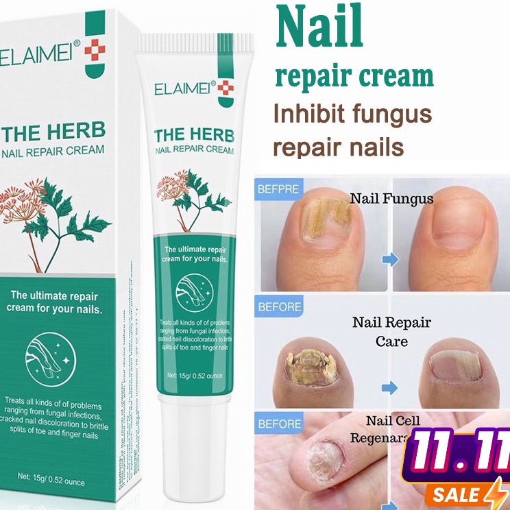 [100% Asli ] ELAIMEI Obat Jamur Kuku Obat Salep Penghilang Jamur Kuku Obat Perawatan Kuku Rusak Anti