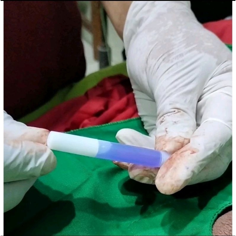 Lem sunat moderen super adhesive / sunathrone seal / perfect seal