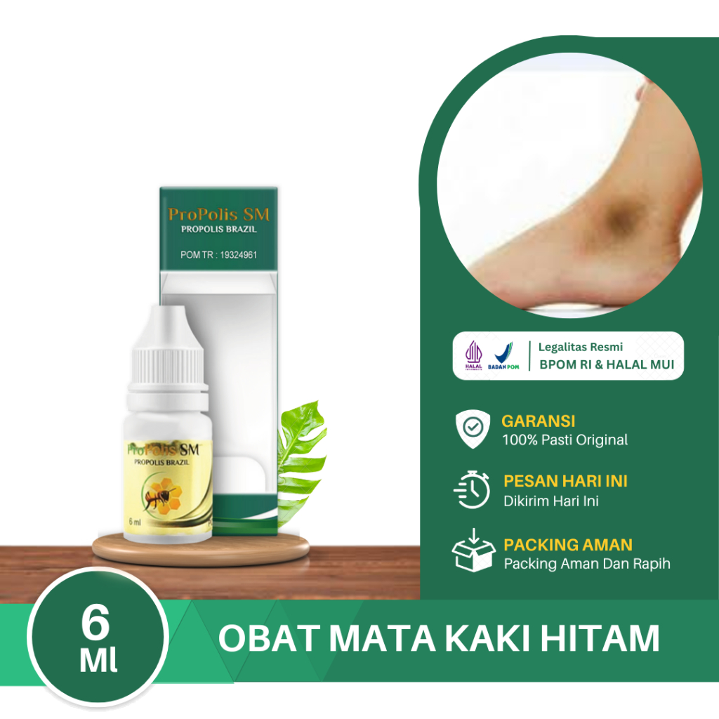 Obat Mata Kaki Hitam, Mata Kaki Hitam & Kasar, Kaki Hitam & Menebal, Sakit Mata Kaki Karena Gesekan 