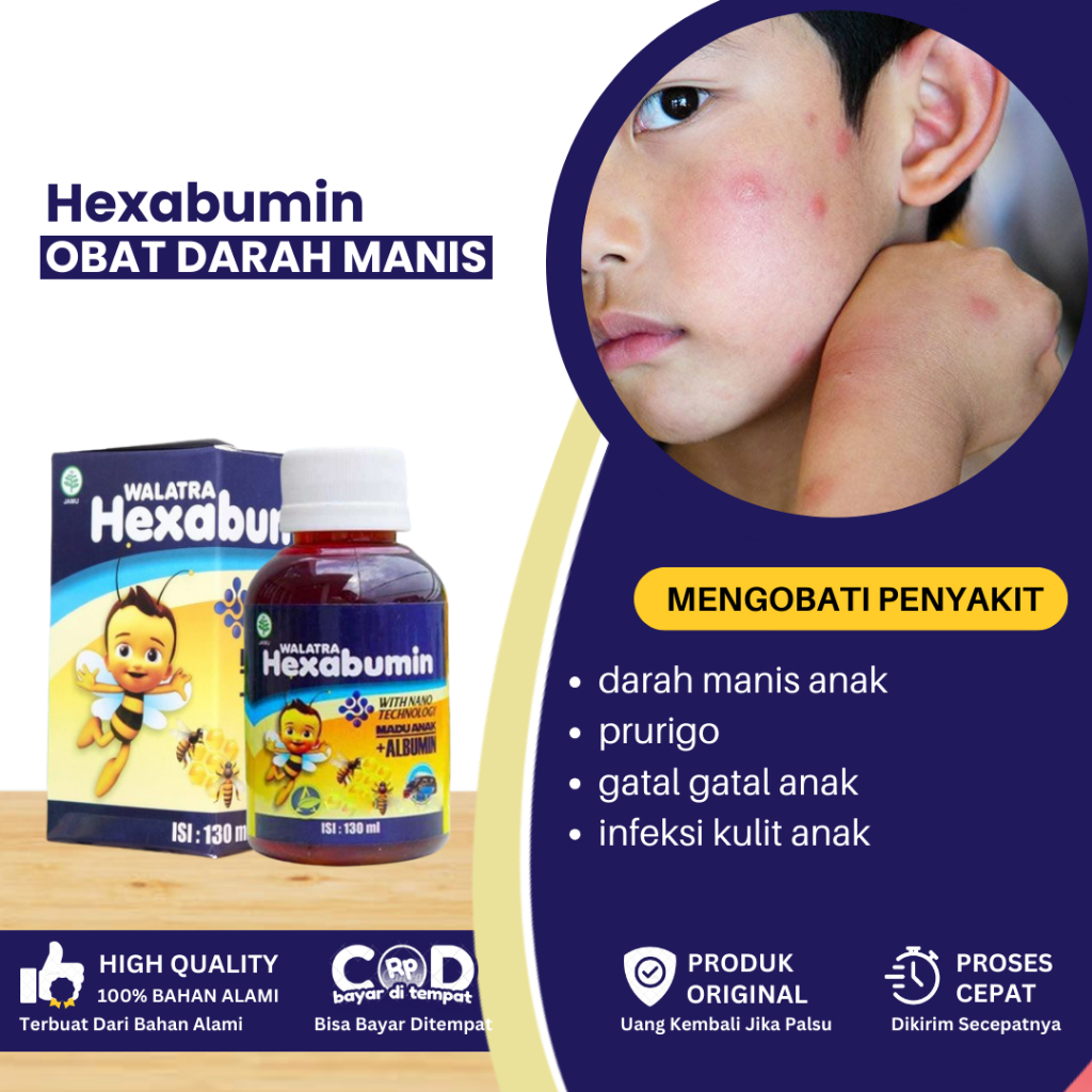 Obat Darah Manis Anak, Penghilang Darah Manis, Obat Prurigo, Obat Gatal - Gatal Anak, Obat Luka Bern