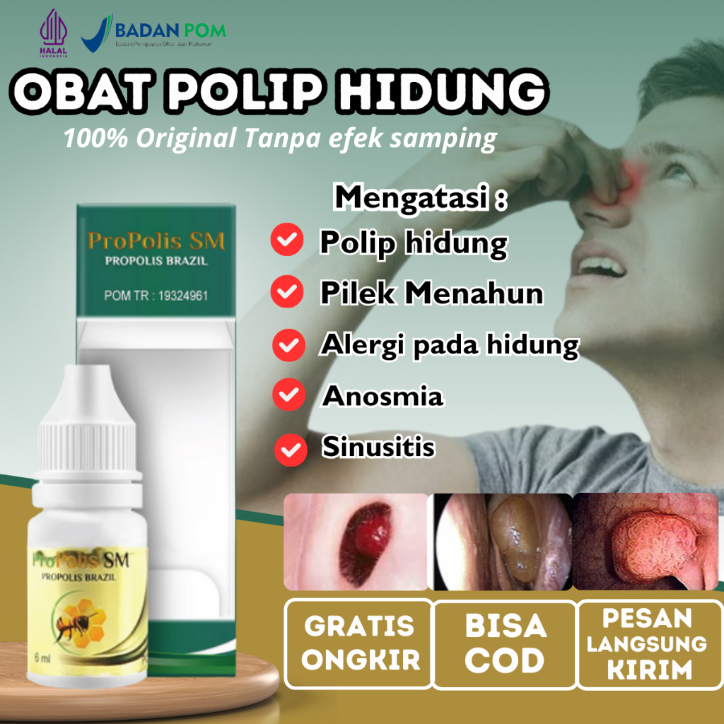 Obat Tetes Polip Hidung, Obat Hidung Tersumbat, Obat herbal Radang Hidung, Obat Alergi Hidung Rhinit