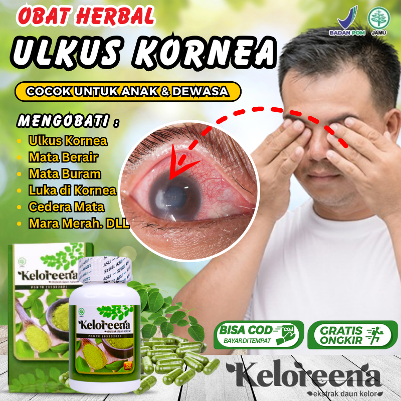 Obat Herbal Ulkus Mata, Obat Cedera Mata, Atasi Luka Terbuka Pada Kornea Mata, Infeksi Kornea Mata, 