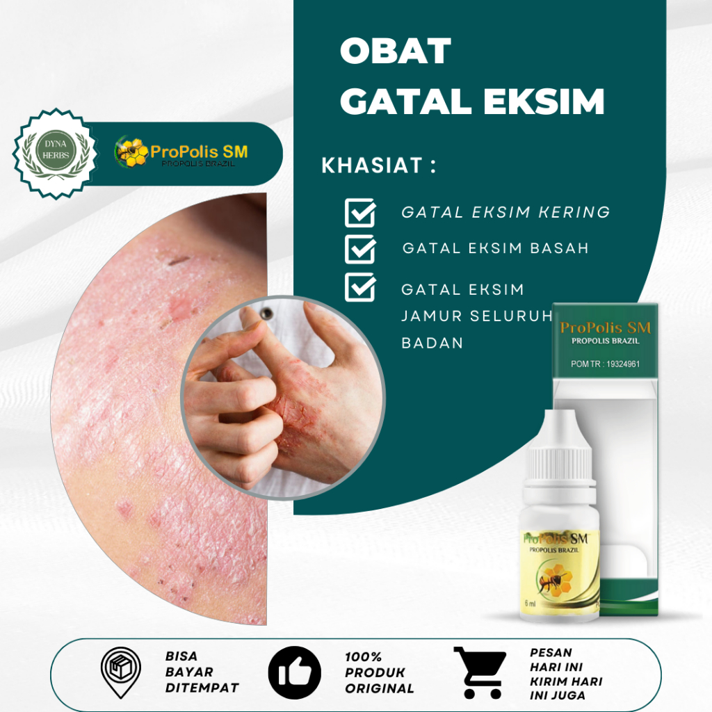 Obat Eksim Basah Kering Menahun, Obat Gatal Eksim, Obat Eksim Gatal, Obat Gatal Eksim Di Selangkanga