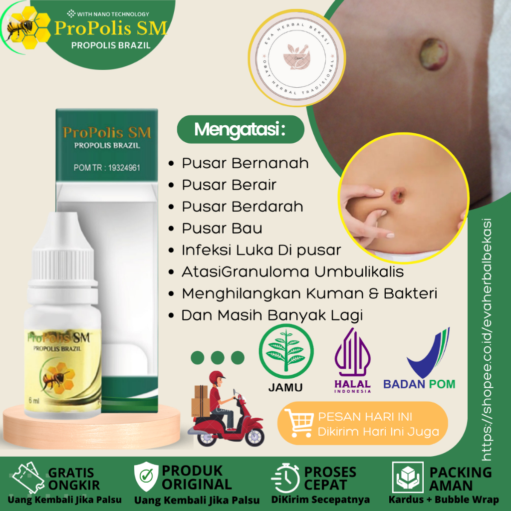 Obat Infeksi Tali Pusar, Obat Pusar Bernanah, Berair & Bau, Udel Berdarah, Gatal, Hitam, Luka Di kul