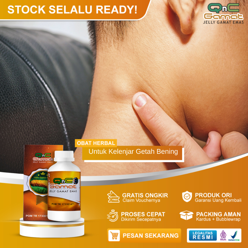 Obat Kelenjar Getah Bening Kelenjar Tiroid Hipertiroid Benjolan Uci Uci Lipoma Gondok Penghancur Ben