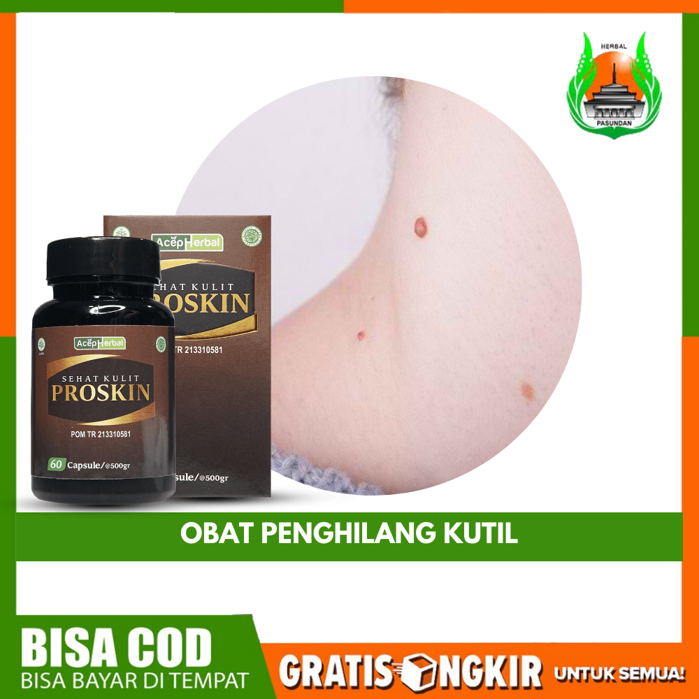 Obat Penghilang Kutil Perontok Kutil Di Tubuh Perontok Kutil kelamin Pria & Wanita  Atasi Dengan Pro