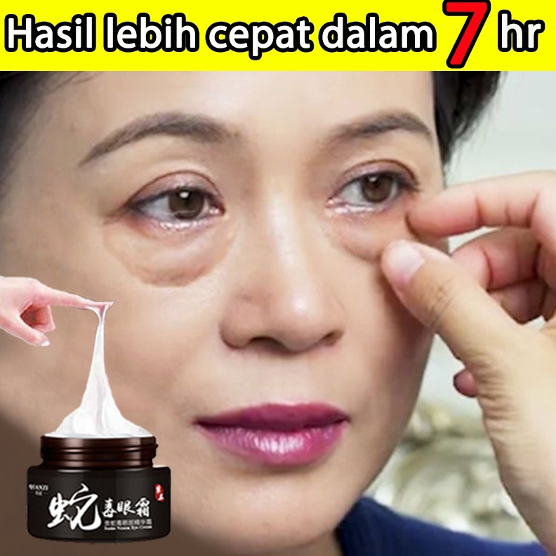 Terbaru dan terlaris QIANZI untuk Mengurangi Dark Circle AntiWrinkle Antiagging Remover Eye terhadap