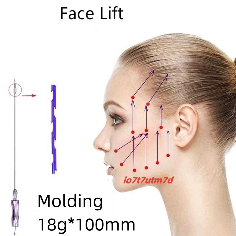 Retail:Minerva Benang Pipi Thread Lift  18g*100mm  PDO/PCL  fishbone/molding/2pcs benang