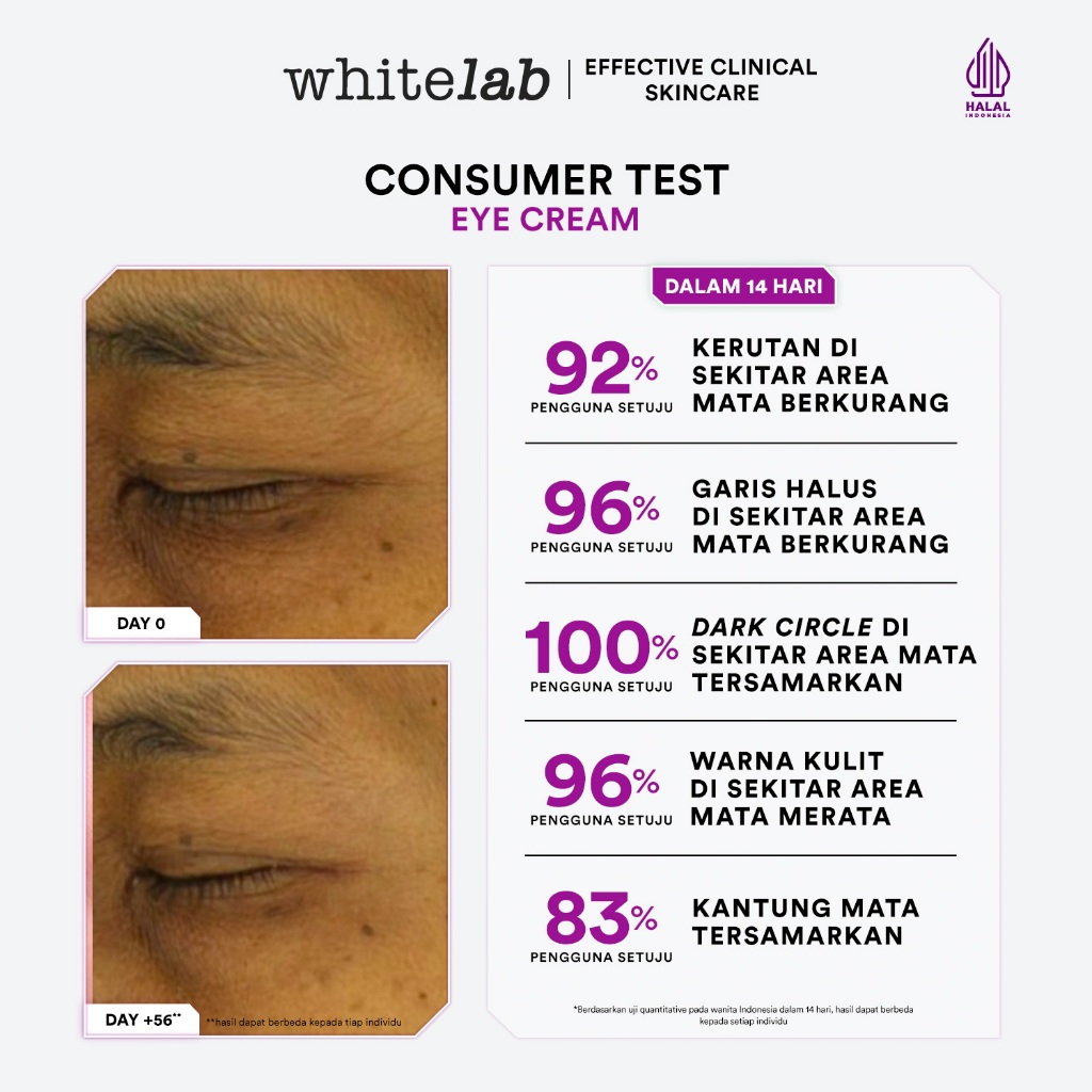 Whitelab Eye Cream - Krim Mata Atasi Kerutan, Garis Halus, Kantung Mata, Dan Mata Panda Dengan Peptide, Caffeine & Niacinamide [BPOM] Image 2
