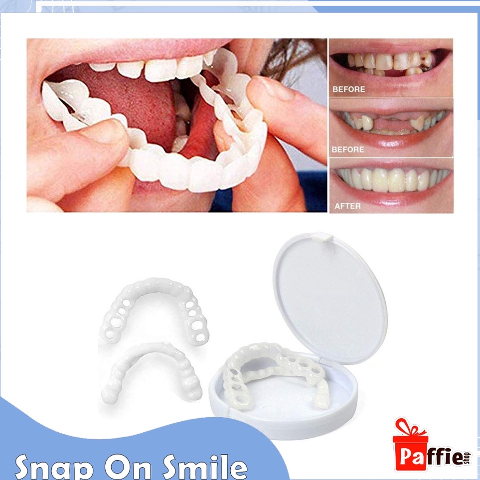 Gigi Palsu Atas Bawah Snap On Smile Gigi Palsu Instan Silikon Snap On Smile Putih Authentic Original