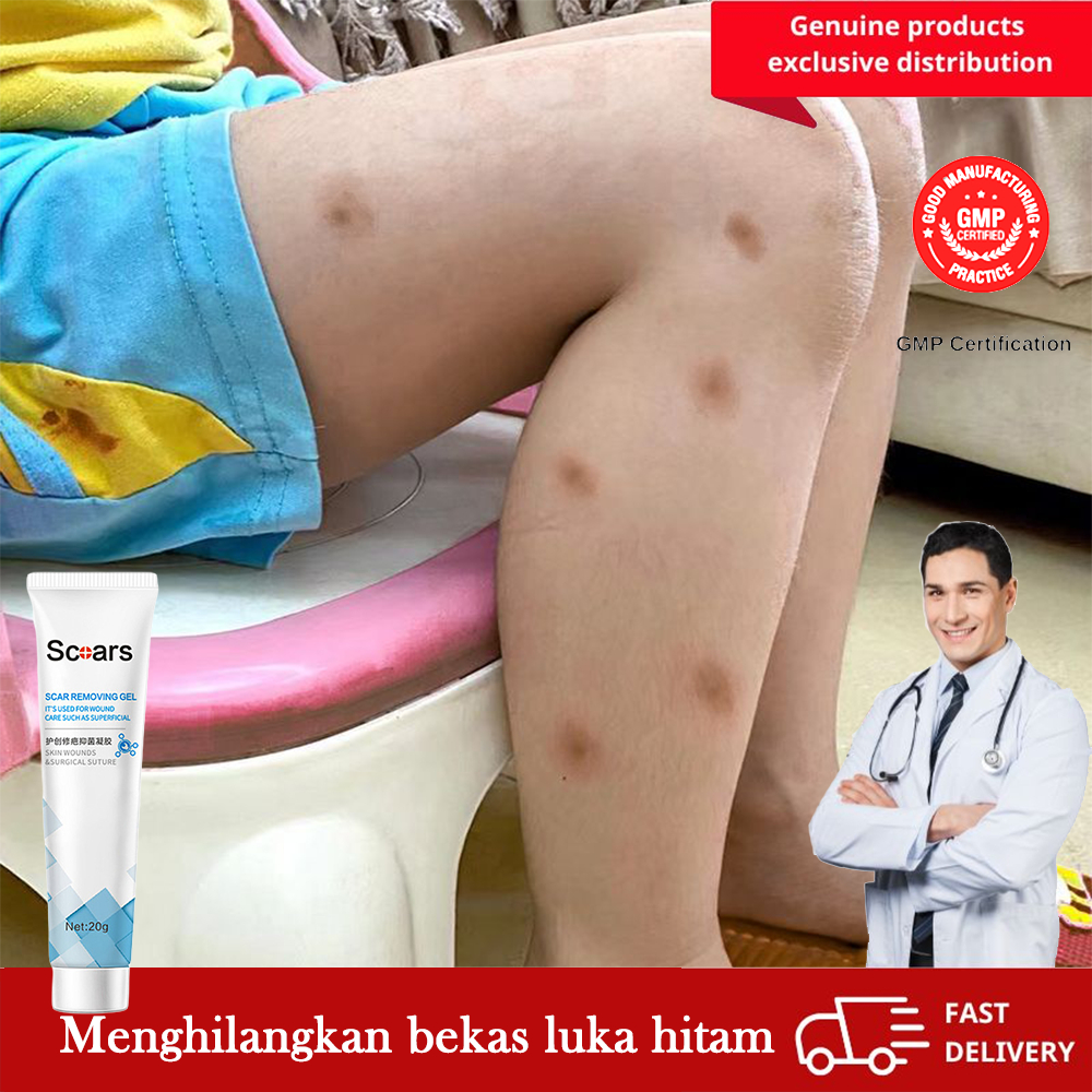 penghilang bekas luka hitam koreng salep penghilang bekas luka hitam Penghilang Koreng Hitam menghil