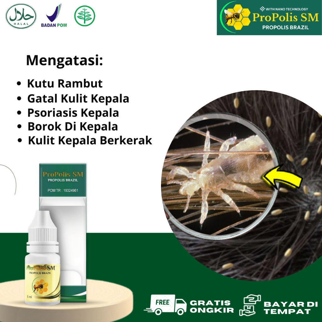 Obat Kutu Rambut, Gatal Kulit Kepala, Pembasmi Kutu Rambut Dan Telurnya, Perawatan Rambut Bukan Pedi