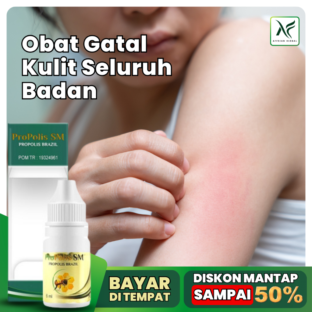 Obat Gatal Kulit Berair, Obat Gatal Kulit, Obat Gatal Kulit Alergi, Obat Gatal Kulit Biduran, Obat K