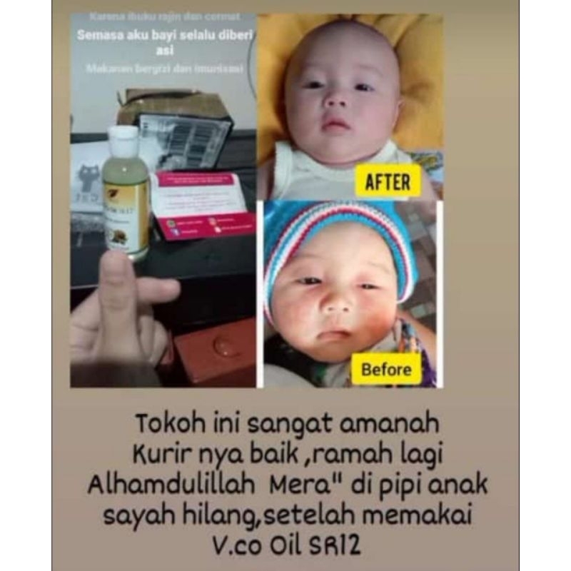 

ADY78 Vco Virgin Coconut Oil/Minyak Kelapa Murni/Vico Oil SR12