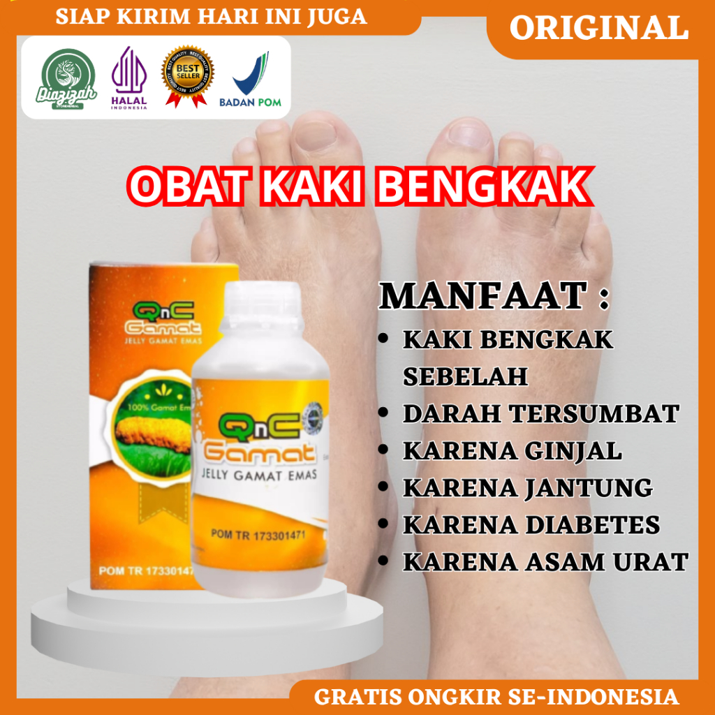 Obat Kaki Bengkak, Obat Penyumbatan Darah, Obat Untuk Kaki Bengkak, Obat Kaki Bengkak Karena Bentura