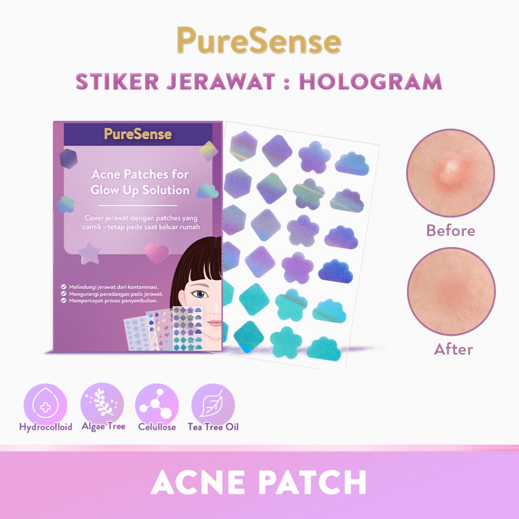 ACNE TREATMENT - HYDROCOLLOID STIKER JERAWAT HYDROCOLLOID ACNE PATCH COLORFUL - STIKER JERAWAT - Sti