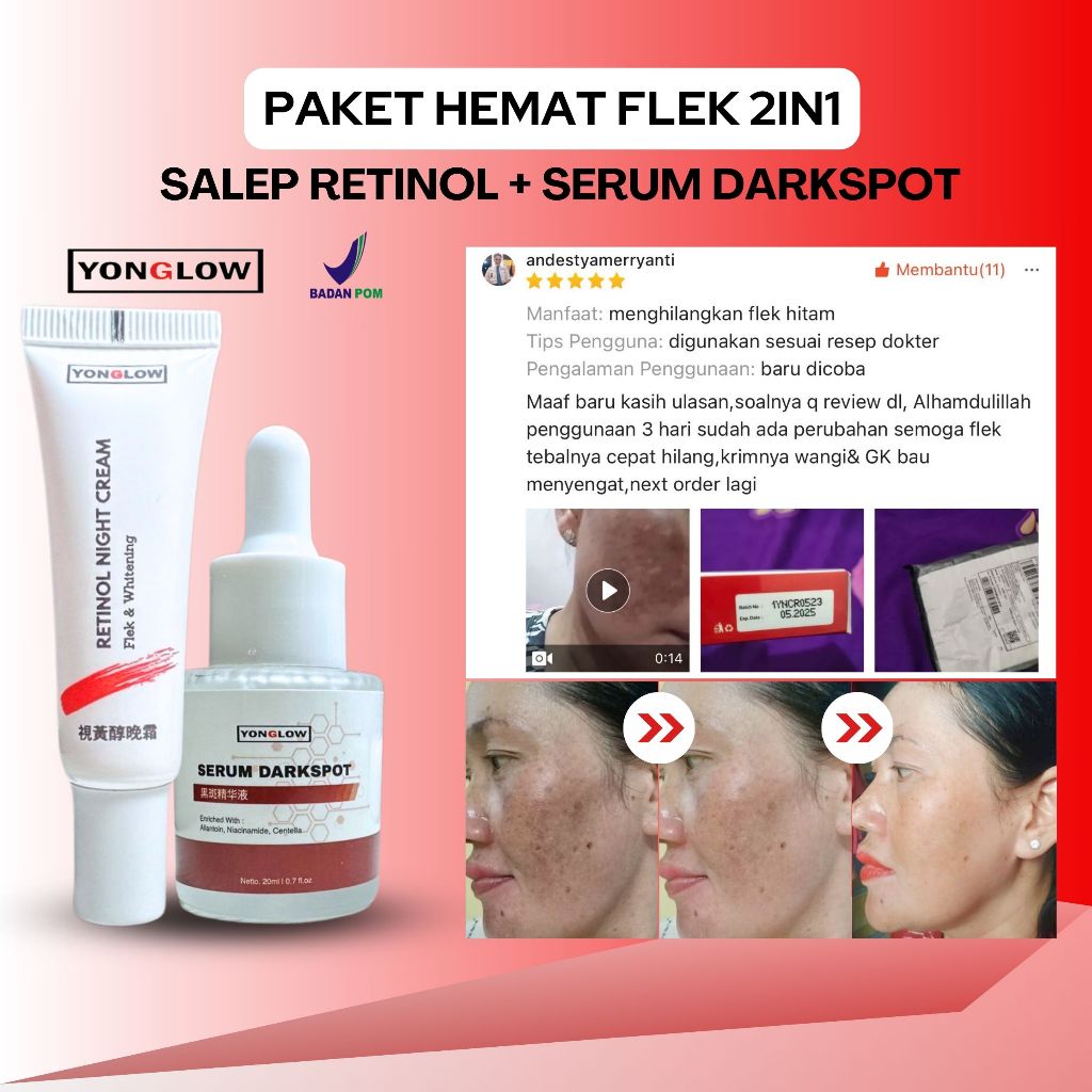 BPOM 2in1 Paket Flek Salep Cina Retinol Serum Darkspot Removal Yonglow Skincare Salep Penghilang Fle