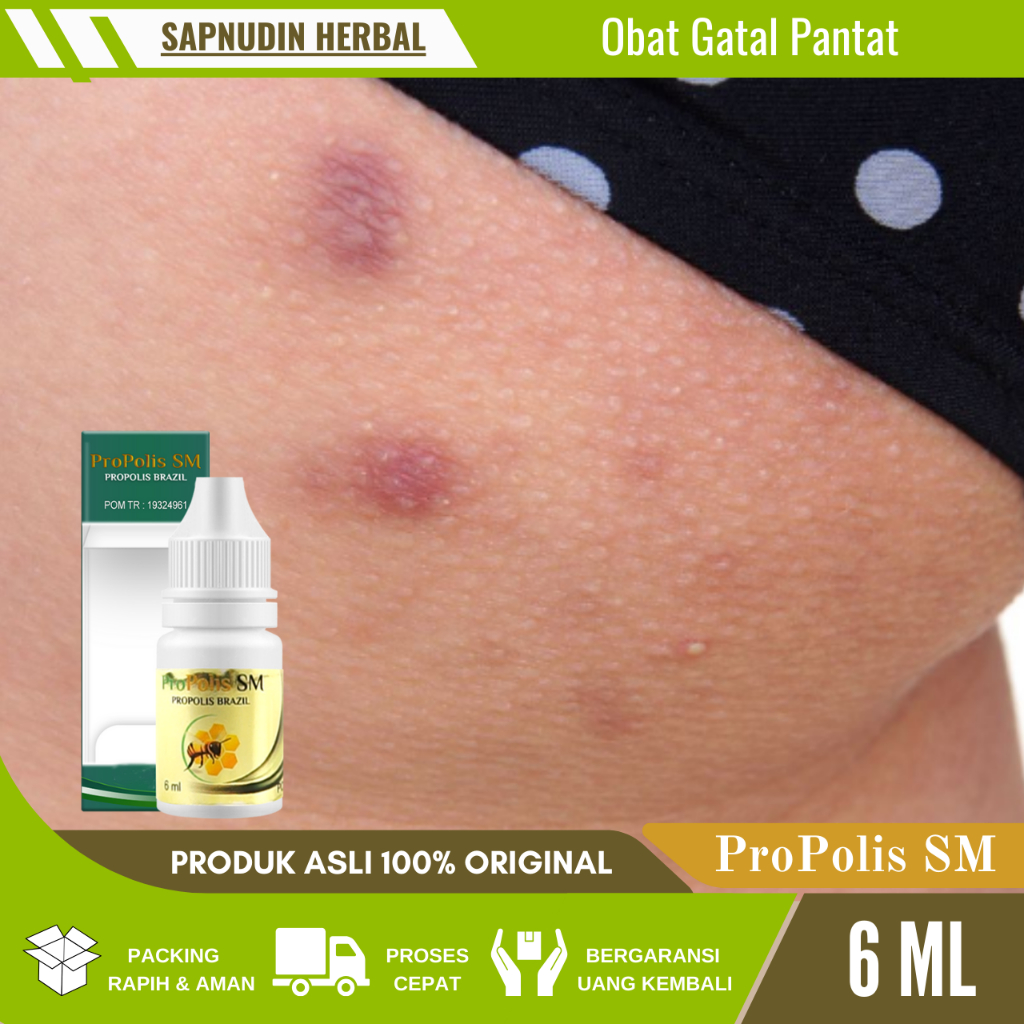 Obat Gatal Gatal Pada Pantat, Obat Bruntusan Di Bokong, Obat Oles Gatal Pantat, Obat Pantat Burik, O