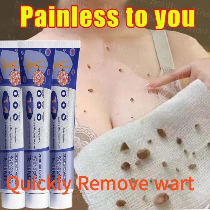 FLASH SALE Obat Penghilang Kutil Pengilang Kutil Dan Tahi Latat Di Wajah Papiloma Wajah Salep Kutil 