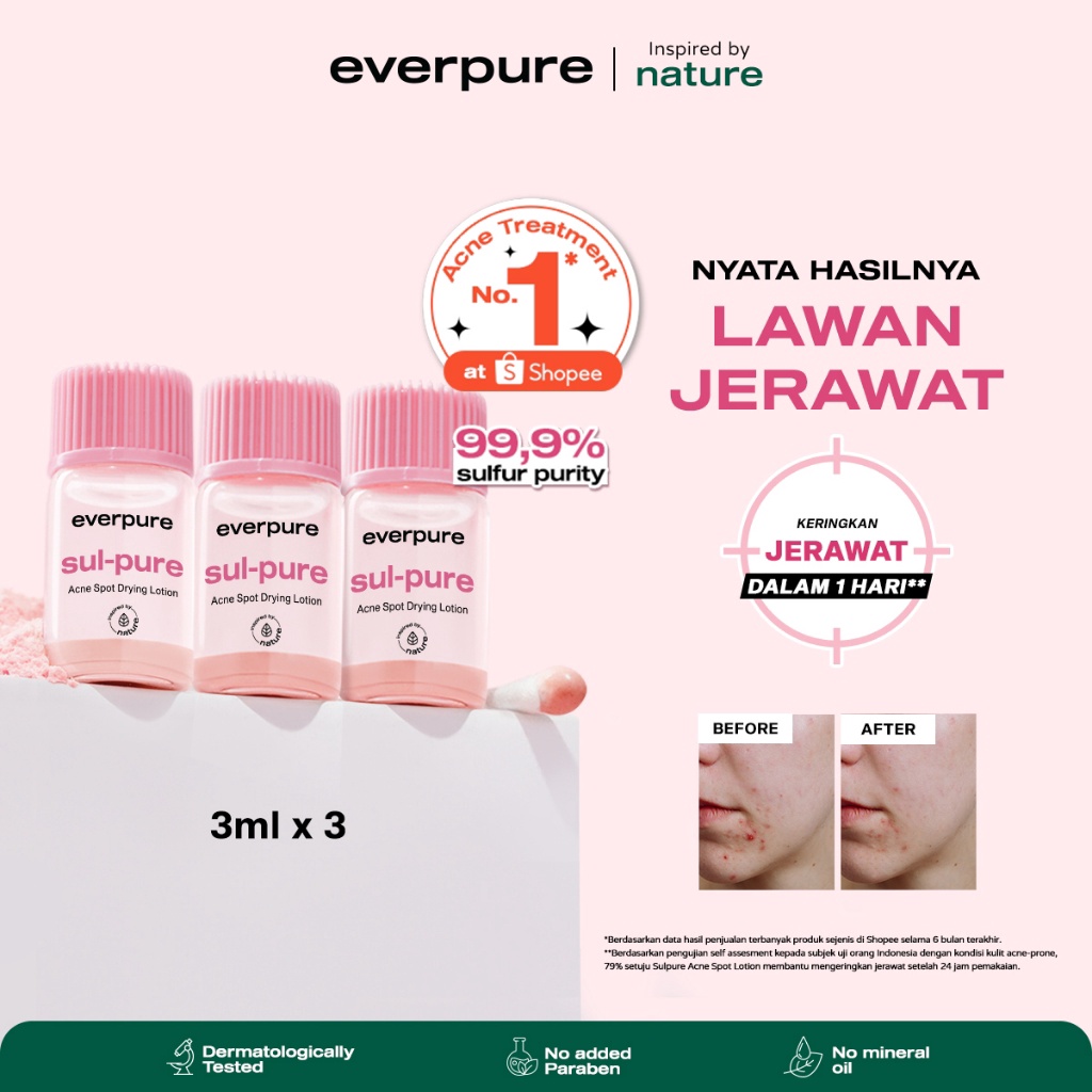 Terlaris Today BUNDLING EVERPURE Sulpure Acne Spot Drying Lotion 3ml x 3pcs Special Affiliate  Obat 