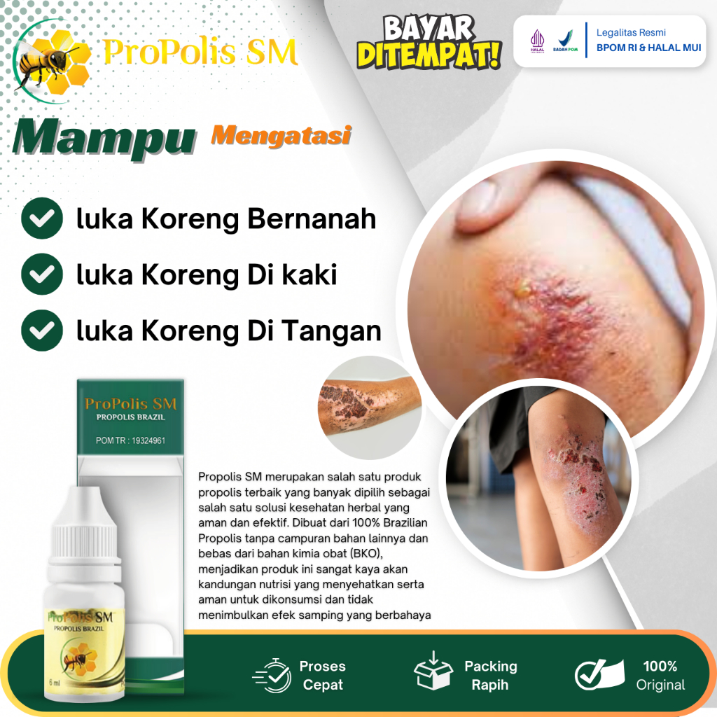 Obat Luka Koreng, Obat Bekas Luka Koreng, Penghilang Bekas Luka Koreng, Obat Koreng Bernanah, Obat B