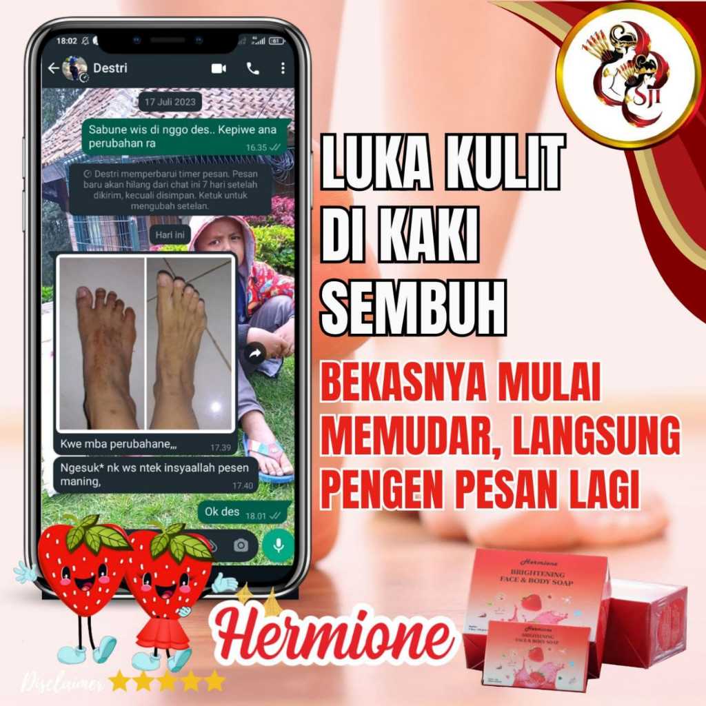 best product terlaris sabun luka penghilang bekas luka bekas luka sabun murah terlaris sabun bekas s