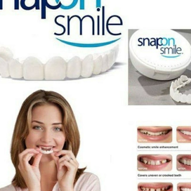 Langka Snap On Smile 1 ORIGINAL Authentic  Gigi Palsu Snapon Smile 1 Set  Gigi Palsu