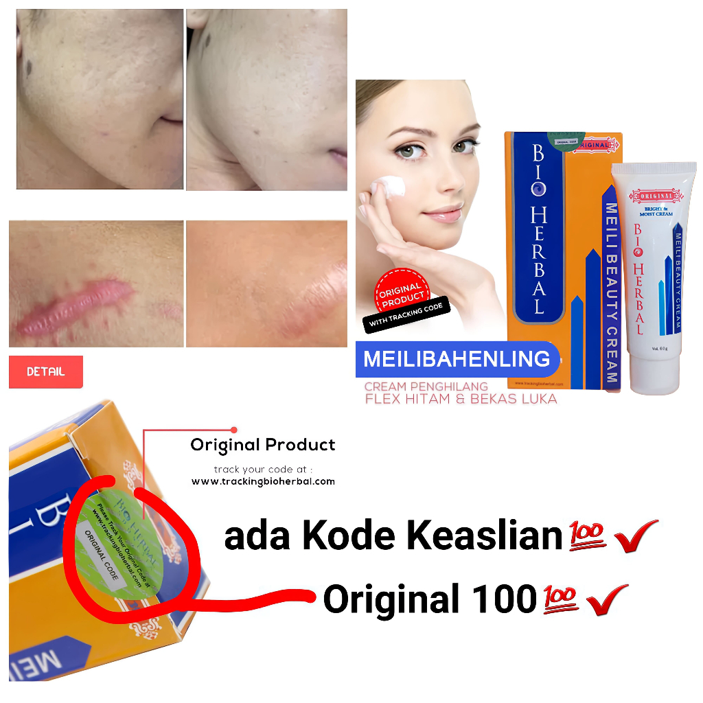Penghilang Bekas Luka Koreng Obat Bekas Strechmark Cream Meilibahenling BPOM Pencerah Badan Penghila