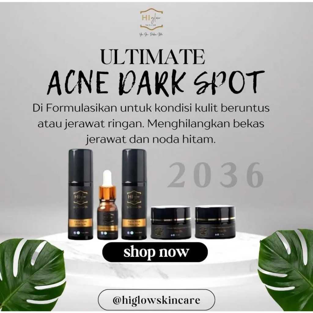 HI GLOW SKINCARE PAKET ULTIMATE ACNE DARK SPOT UNTUK JERAWAT DAN BEKAS JERAWAT - FREE ONGKIR