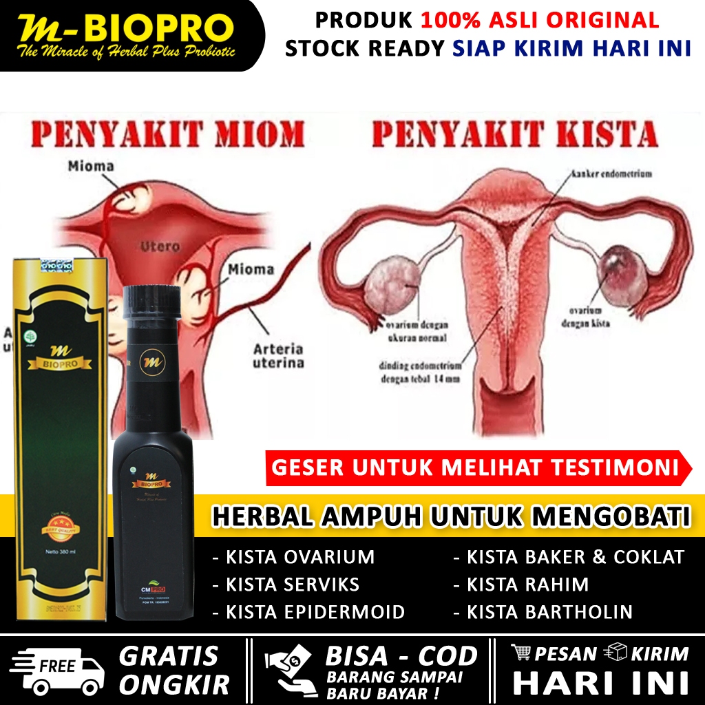 Obat Kista Miom Tanpa Operasi MBIOPRO Penyumbatan Tuba Falopi Tersumbat Penghancur kista Ovarium Brt